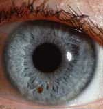 Iridology Help Heel Dr. Tony Koufos