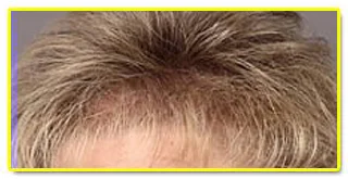 Hair Analysis to your Health